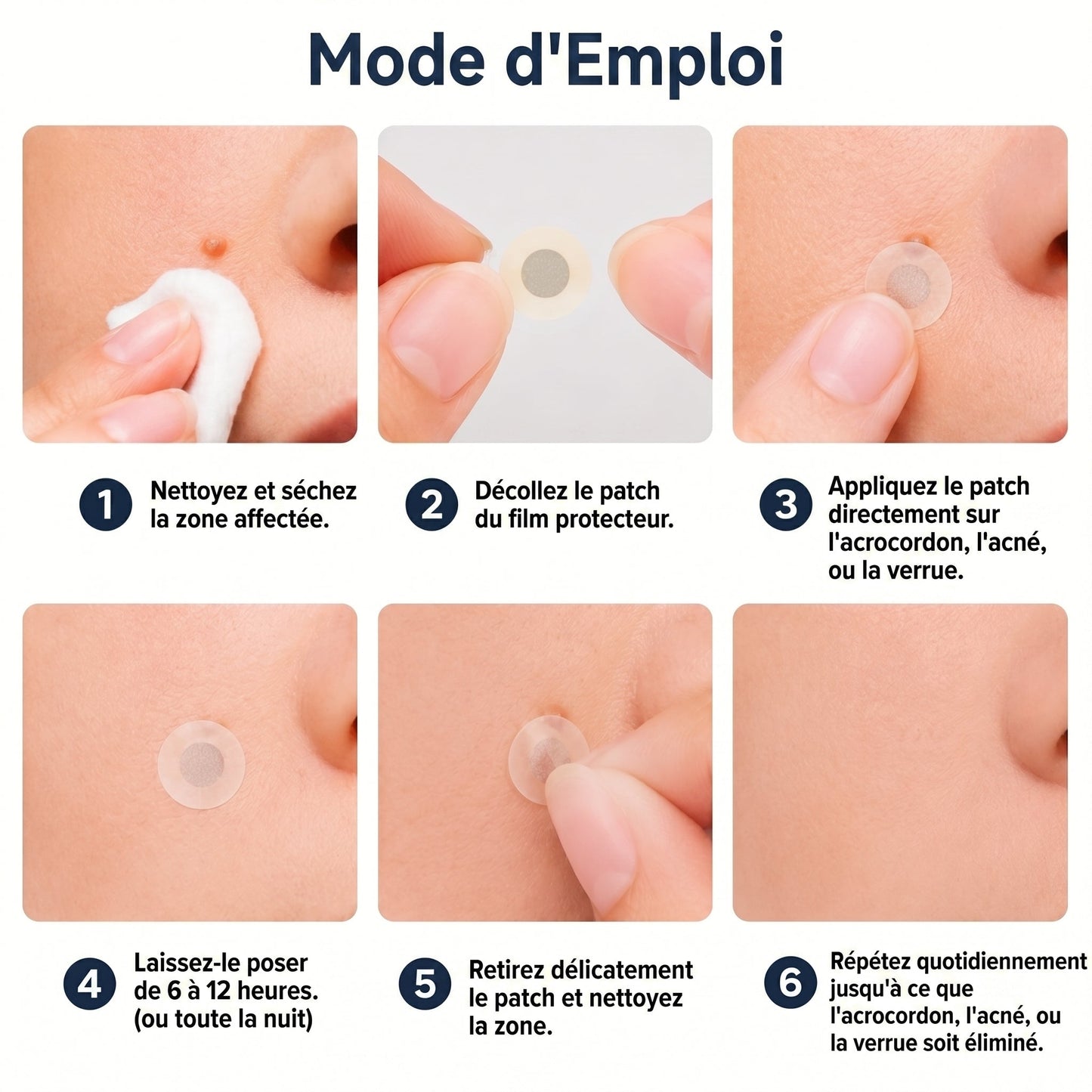 𝐏𝑬𝗔𝙍𝙇𝐌𝑶𝗢𝙉® 𝐏𝐚𝐭𝐜𝐡 𝐌𝐢𝐜𝐫𝐨𝐧𝐞𝐞𝐝𝐥𝐞 & 𝐇𝐲𝐝𝐫𝐨𝐜𝐨𝐥𝐥𝐨ï𝐝𝐞 𝟐-𝐞𝐧-𝟏🍀 | 𝐀𝐢𝐝𝐞 à é𝐥𝐢𝐦𝐢𝐧𝐞𝐫 𝐥'𝐚𝐜𝐧é, 𝐥𝐞𝐬 𝐯𝐞𝐫𝐫𝐮𝐞𝐬 𝐩𝐥𝐚𝐧𝐞𝐬 𝐞𝐭 𝐥𝐞𝐬 𝐚𝐜𝐫𝐨𝐜𝐡𝐨𝐫𝐝𝐨𝐧𝐬 | 𝐀𝐢𝐝𝐞 à 𝐚𝐭𝐭é𝐧𝐮𝐞𝐫 𝐥𝐞𝐬 𝐫𝐢𝐝𝐞𝐬, 𝐥𝐞𝐬 𝐜𝐢𝐜𝐚𝐭𝐫𝐢𝐜𝐞𝐬 𝐞𝐭 𝐥𝐞𝐬 𝐢𝐦𝐩𝐞𝐫𝐟𝐞𝐜𝐭𝐢𝐨𝐧𝐬 | 𝐏𝐚𝐭𝐜𝐡𝐬 𝐢𝐧𝐯𝐢𝐬𝐢𝐛𝐥𝐞𝐬 𝐩𝐨𝐮𝐫 𝐥𝐞 𝐯𝐢𝐬𝐚𝐠𝐞 𝐞𝐭 𝐥𝐞 𝐜𝐨𝐫𝐩𝐬