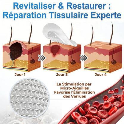 𝐏𝑬𝗔𝙍𝙇𝐌𝑶𝗢𝙉® 𝐏𝐚𝐭𝐜𝐡 𝐌𝐢𝐜𝐫𝐨𝐧𝐞𝐞𝐝𝐥𝐞 & 𝐇𝐲𝐝𝐫𝐨𝐜𝐨𝐥𝐥𝐨ï𝐝𝐞 𝟐-𝐞𝐧-𝟏🍀 | 𝐀𝐢𝐝𝐞 à é𝐥𝐢𝐦𝐢𝐧𝐞𝐫 𝐥'𝐚𝐜𝐧é, 𝐥𝐞𝐬 𝐯𝐞𝐫𝐫𝐮𝐞𝐬 𝐩𝐥𝐚𝐧𝐞𝐬 𝐞𝐭 𝐥𝐞𝐬 𝐚𝐜𝐫𝐨𝐜𝐡𝐨𝐫𝐝𝐨𝐧𝐬 | 𝐀𝐢𝐝𝐞 à 𝐚𝐭𝐭é𝐧𝐮𝐞𝐫 𝐥𝐞𝐬 𝐫𝐢𝐝𝐞𝐬, 𝐥𝐞𝐬 𝐜𝐢𝐜𝐚𝐭𝐫𝐢𝐜𝐞𝐬 𝐞𝐭 𝐥𝐞𝐬 𝐢𝐦𝐩𝐞𝐫𝐟𝐞𝐜𝐭𝐢𝐨𝐧𝐬 | 𝐏𝐚𝐭𝐜𝐡𝐬 𝐢𝐧𝐯𝐢𝐬𝐢𝐛𝐥𝐞𝐬 𝐩𝐨𝐮𝐫 𝐥𝐞 𝐯𝐢𝐬𝐚𝐠𝐞 𝐞𝐭 𝐥𝐞 𝐜𝐨𝐫𝐩𝐬